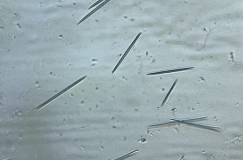 pineapple under microscope