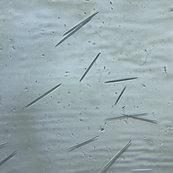 pineapple under microscope
