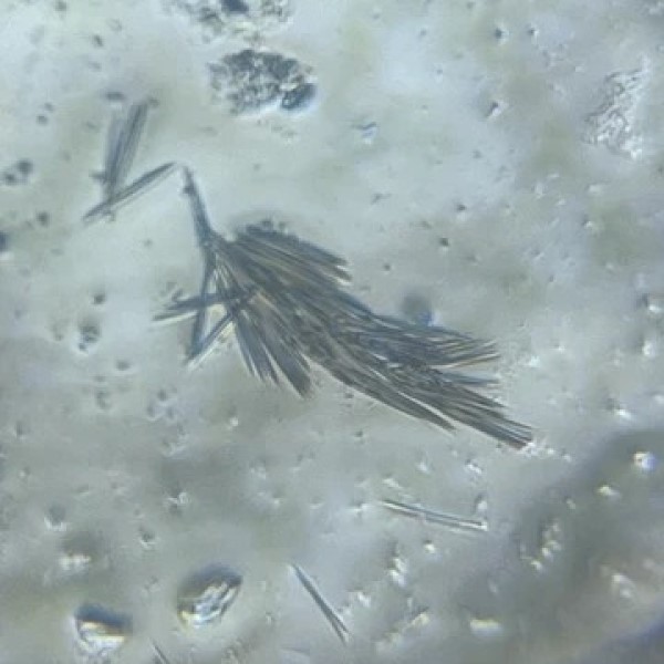 pineapple under microscope