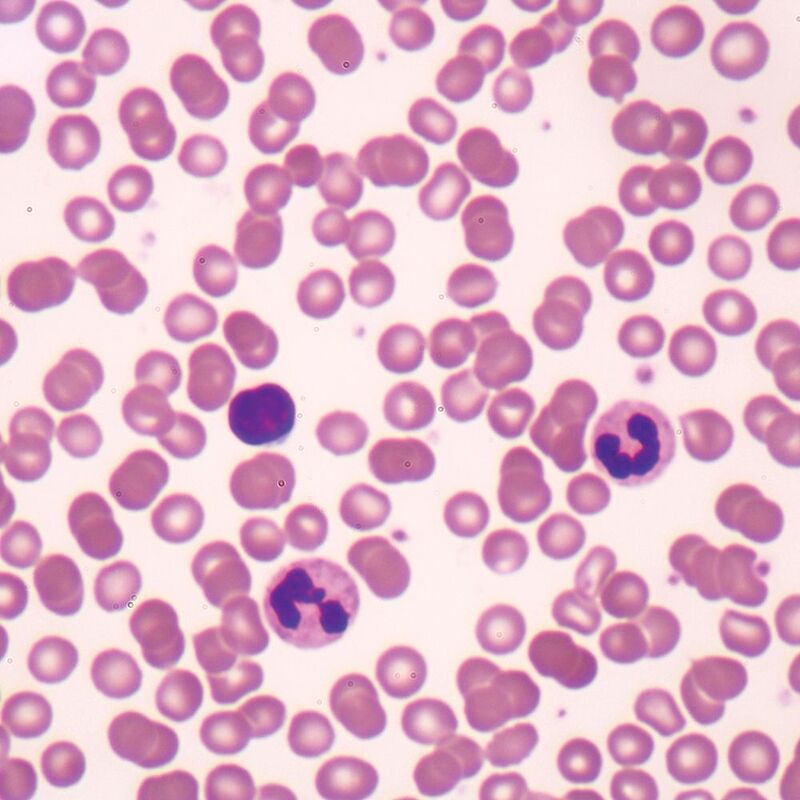 Blood under microscope