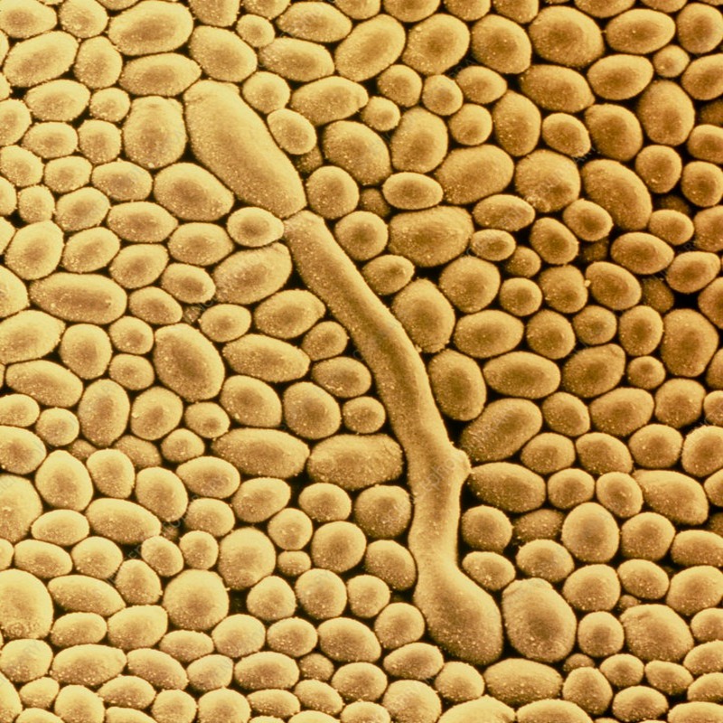 Yeast under microscope