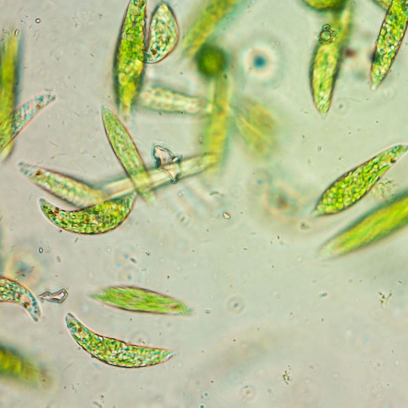 Euglena under microscope