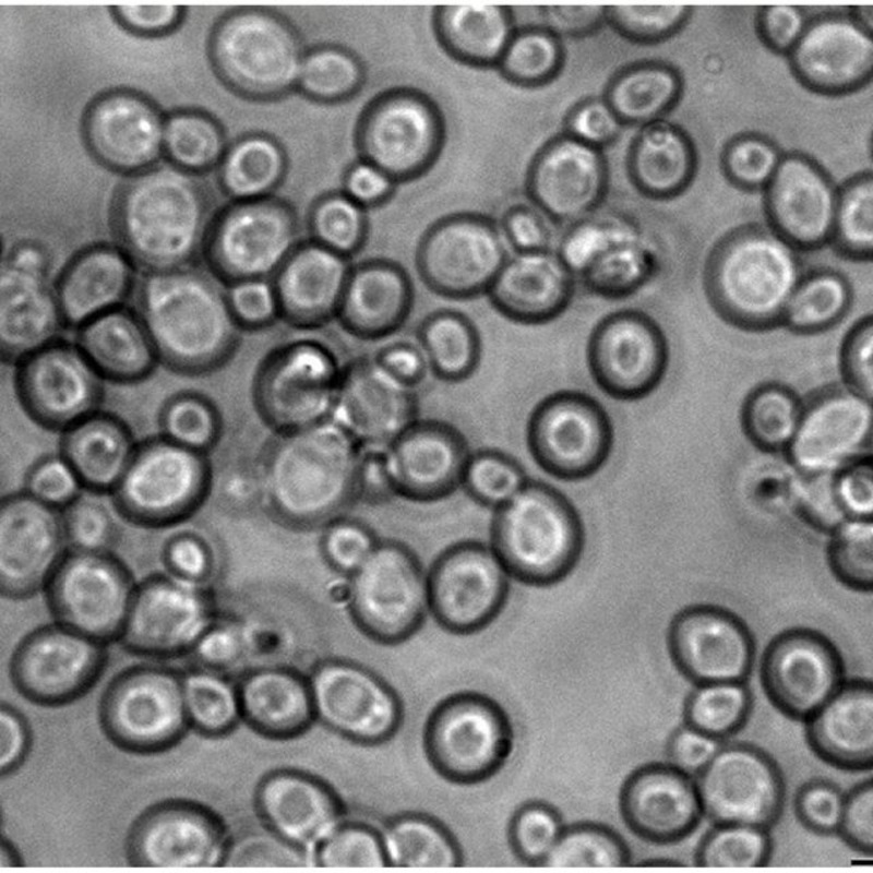 Yeast under microscope