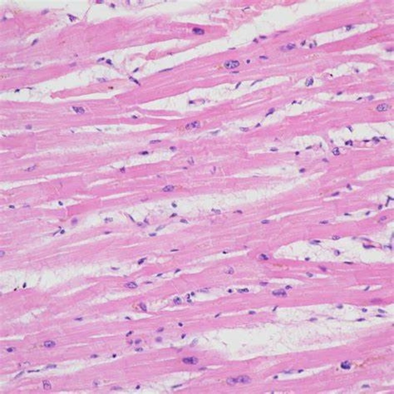 Skeletal muscle under the microscope