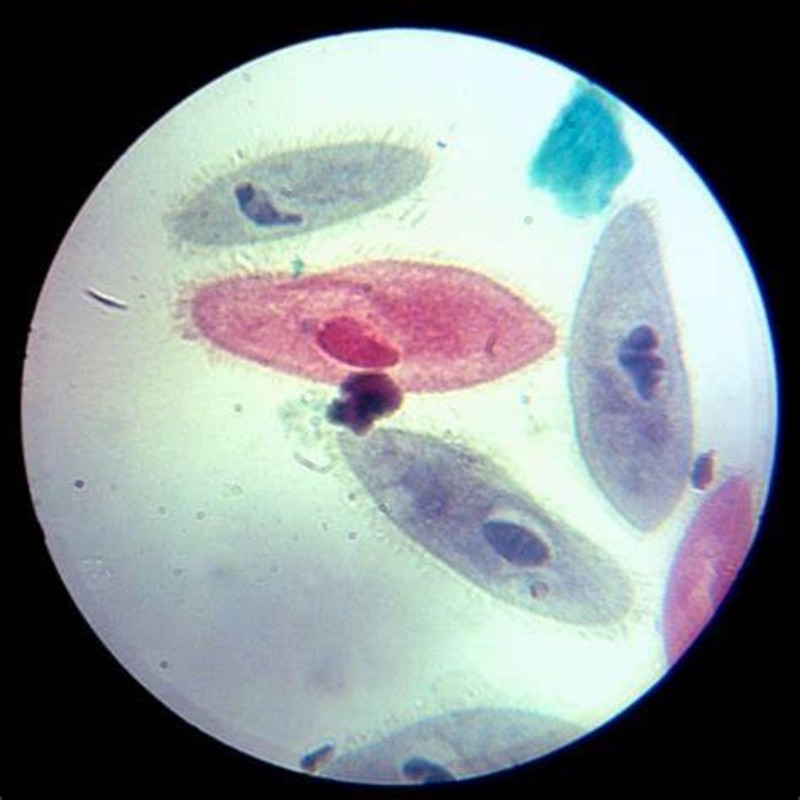 Paramecium under microscope