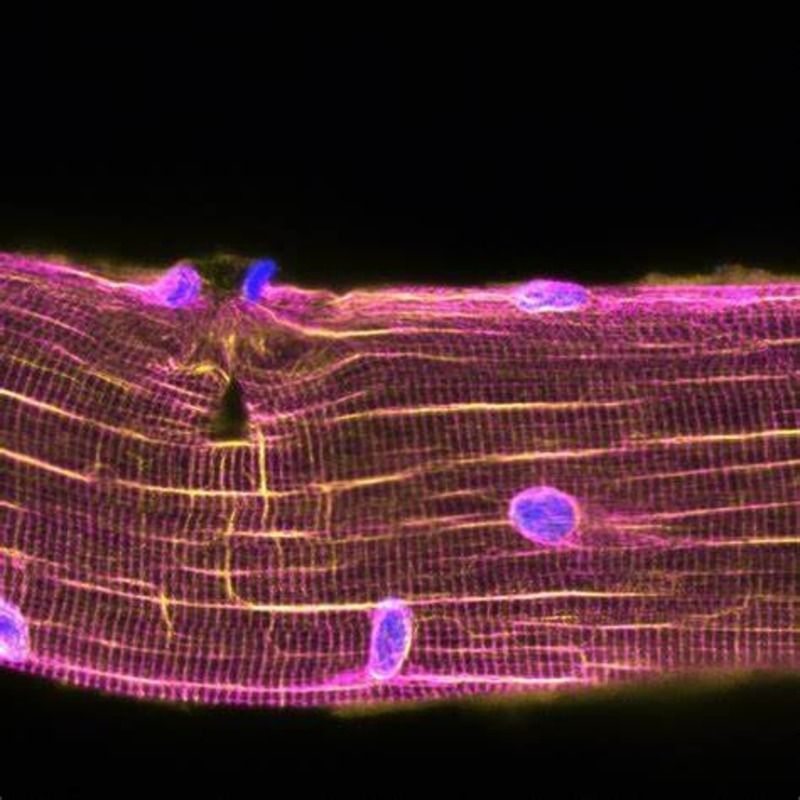 Skeletal muscle under the microscope