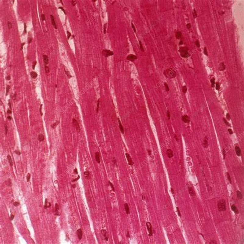 Cardiac muscle under microscope