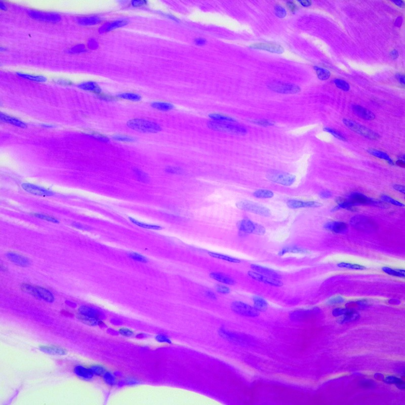 Skeletal muscle under the microscope