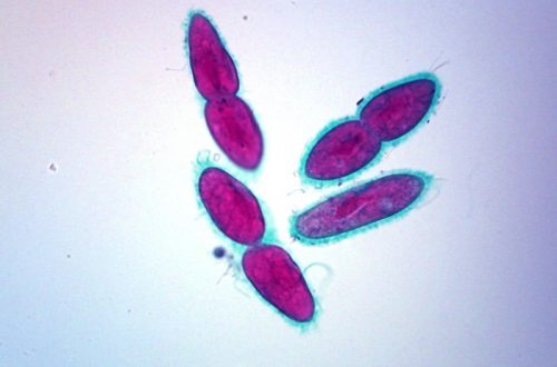 Paramecium under microscope