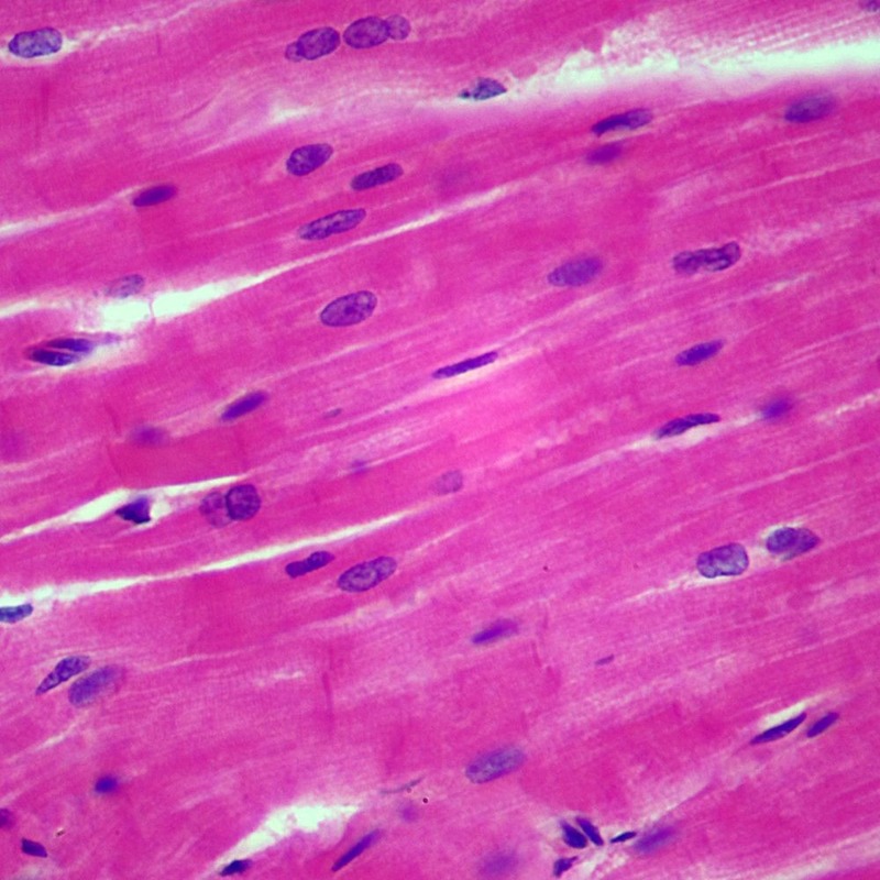 Cardiac muscle under microscope