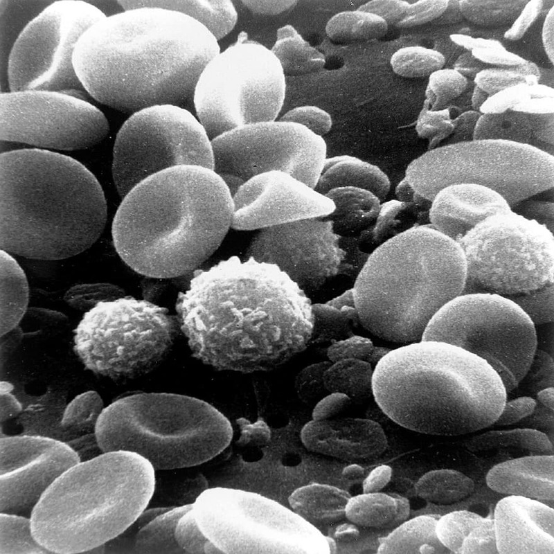 White blood cells under microscope