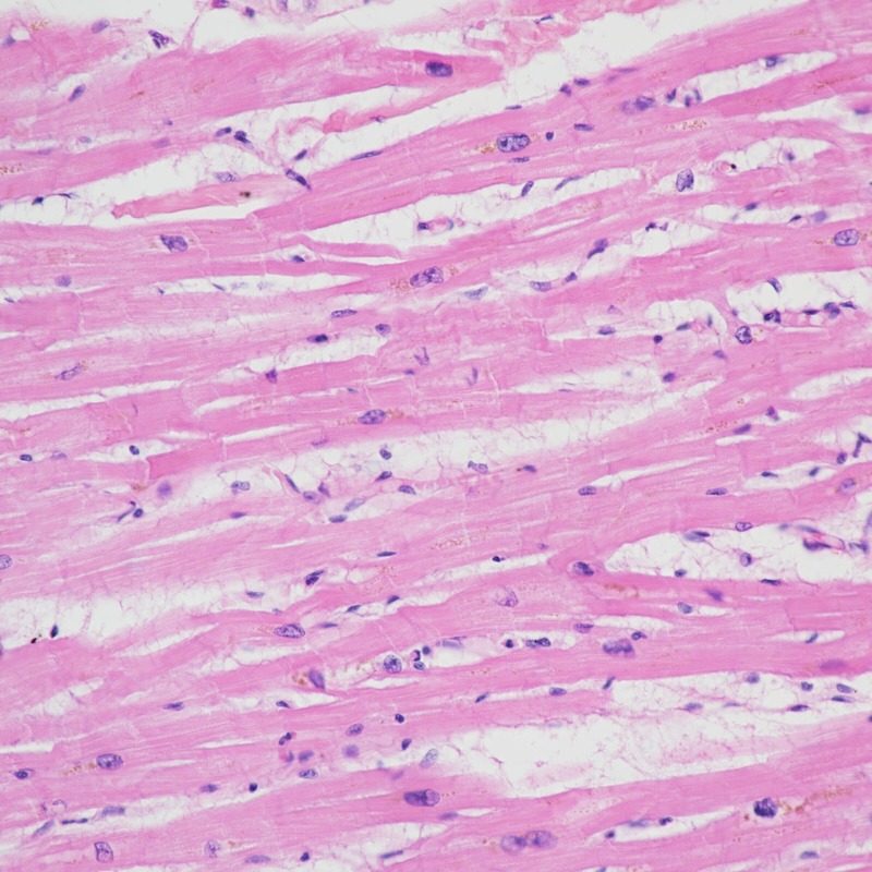 Cardiac muscle under microscope