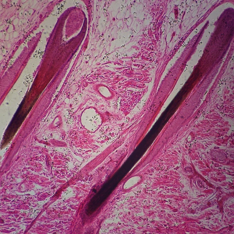 Skin under microscope