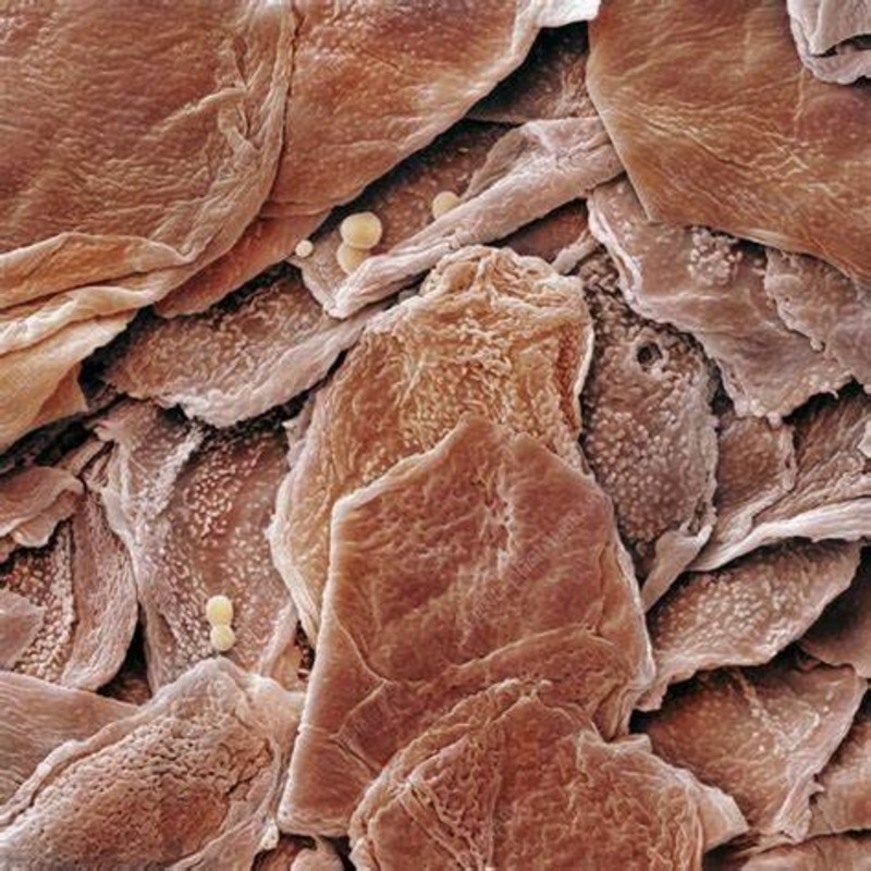 Skin under microscope