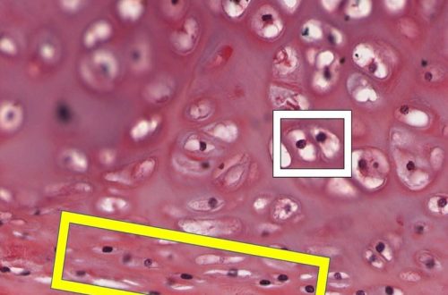 Hyaline cartilage under microscope