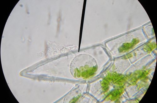 Cell under microscope