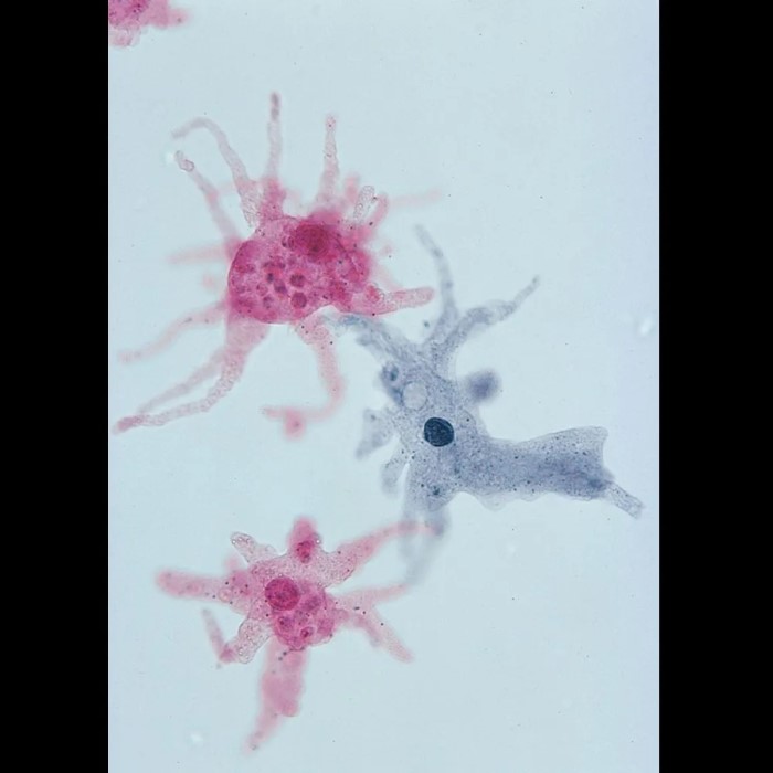 amoeba under microscope
