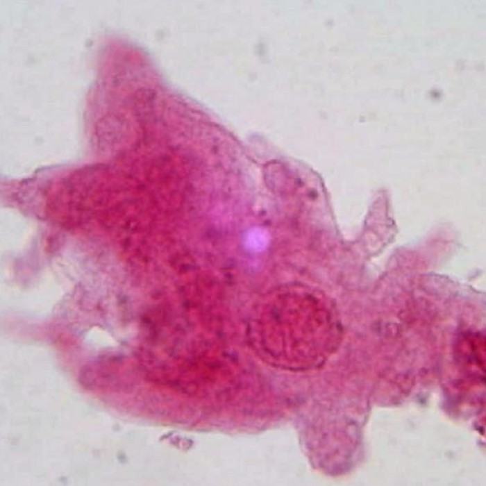 amoeba under microscope