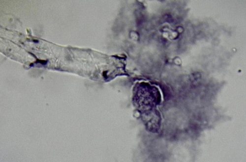 amoeba under microscope