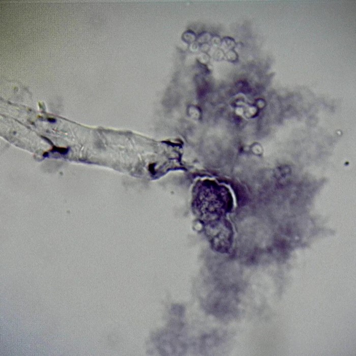 amoeba under microscope