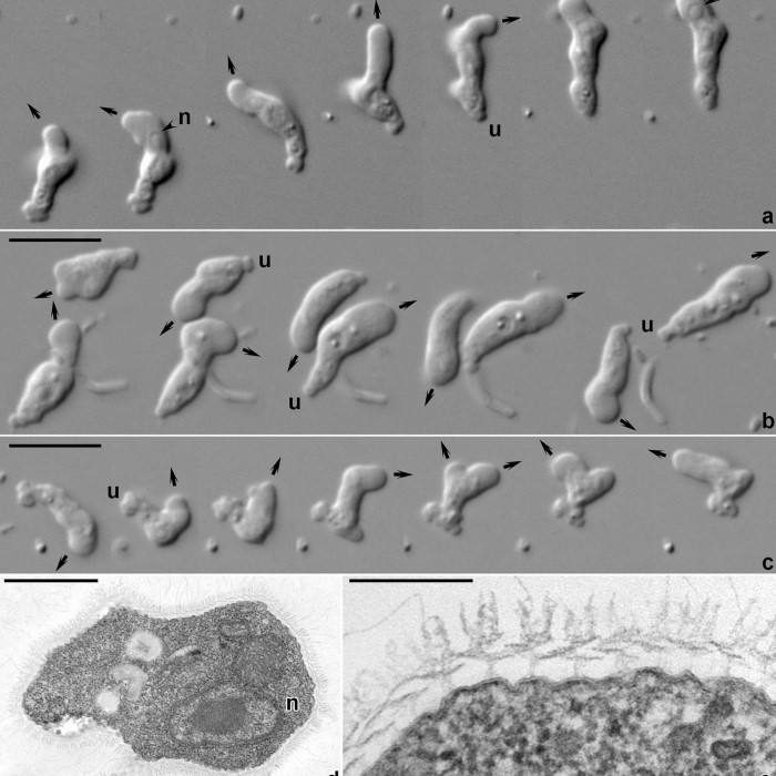 amoeba under microscope