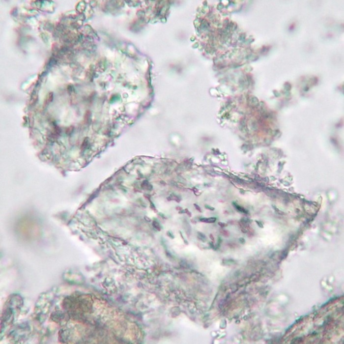 human ashes under microscope