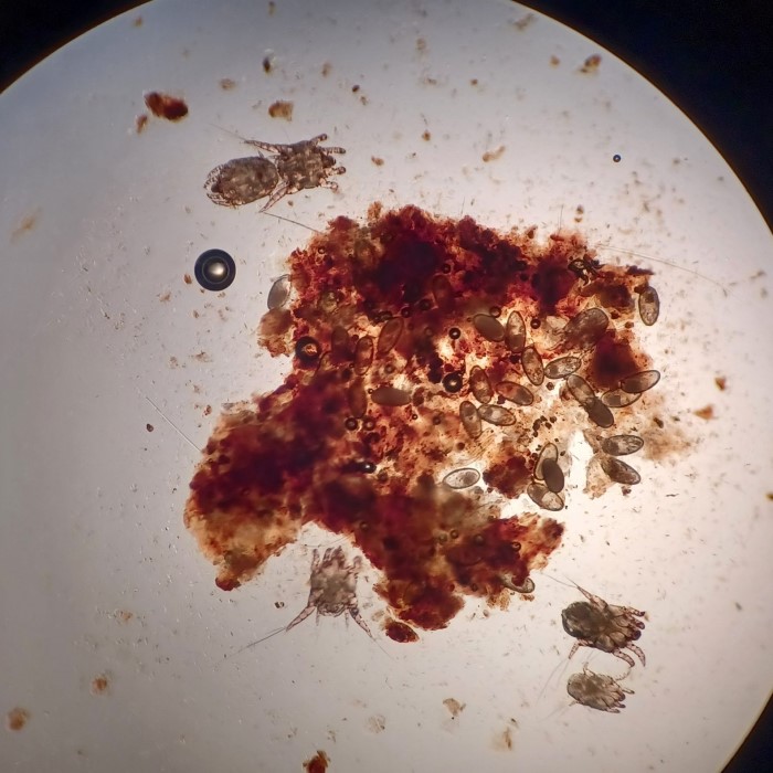 dog ear mites under microscope