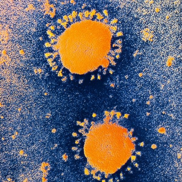 what does a virus look like under a microscope