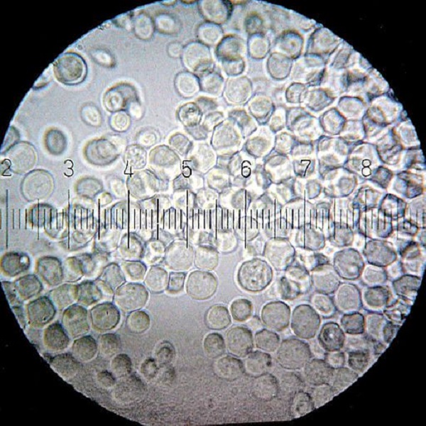 what does yeast look like under a microscope