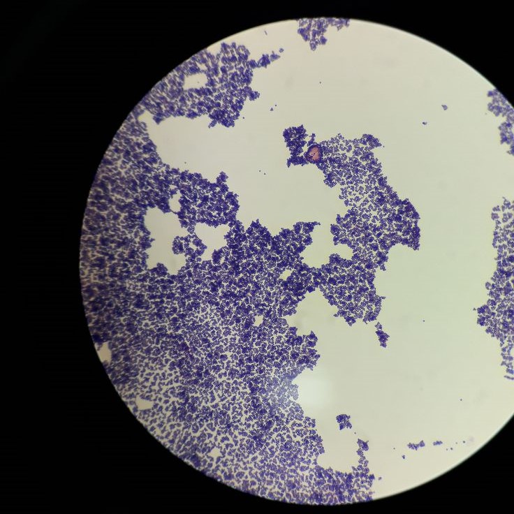 what does bacteria look like under a microscope