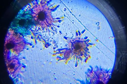 what does a virus look like under a microscope