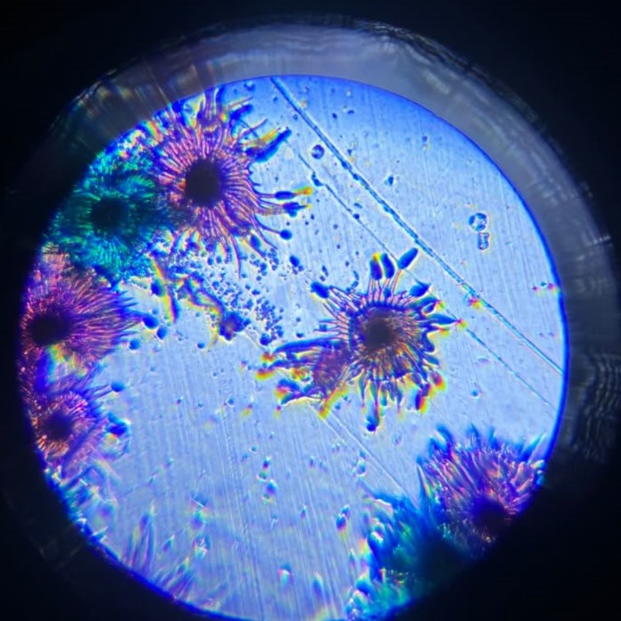 what does a virus look like under a microscope