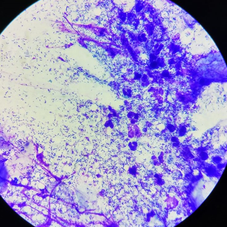 what does bacteria look like under a microscope