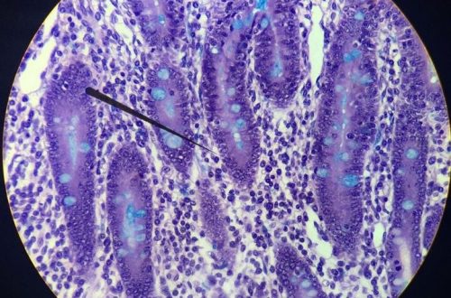 what does bacteria look like under a microscope