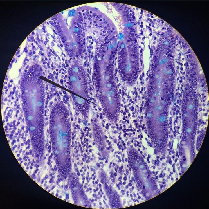 what does bacteria look like under a microscope