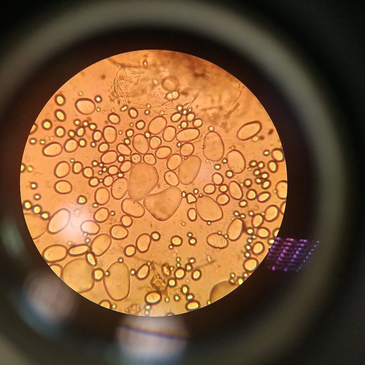 microscope discoveries