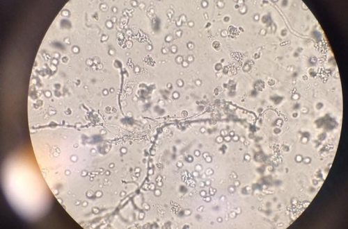 what does yeast look like under a microscope