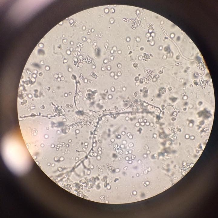 what does yeast look like under a microscope