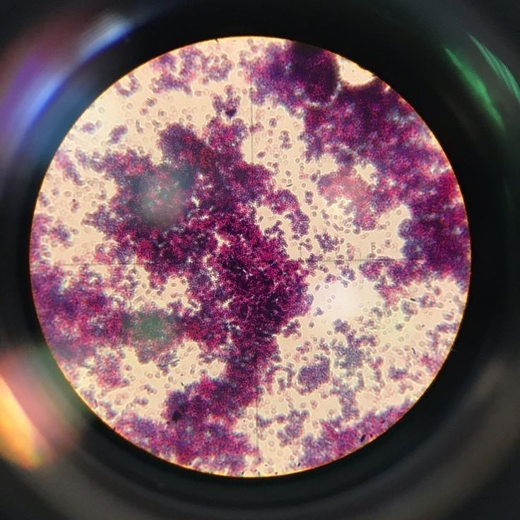 what does a virus look like under a microscope
