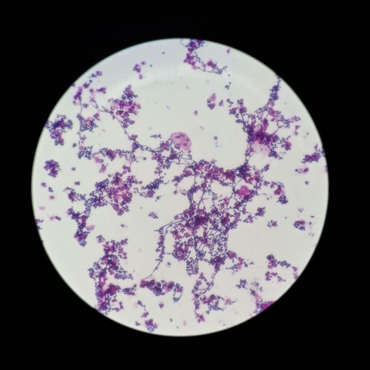 what does bacteria look like under a microscope