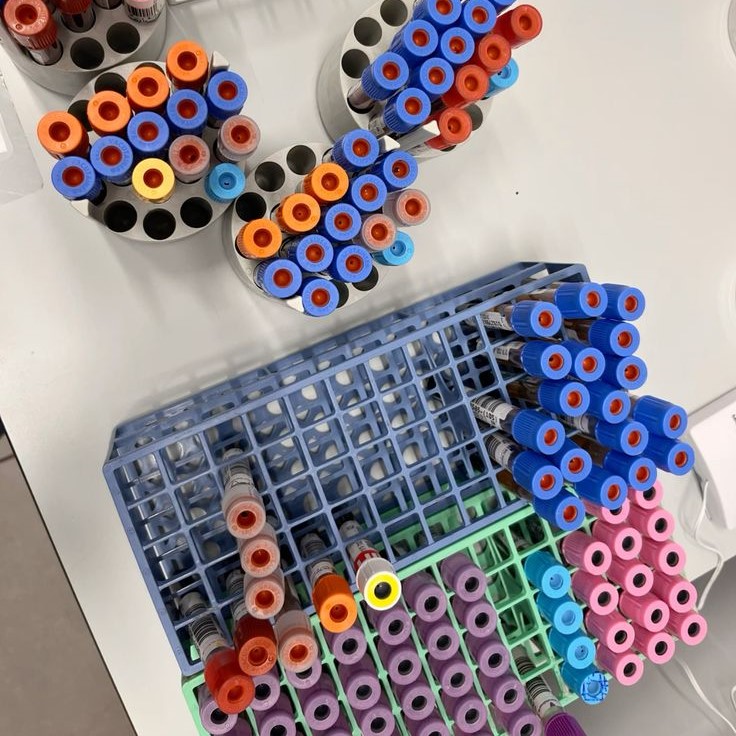 cbc test tube color