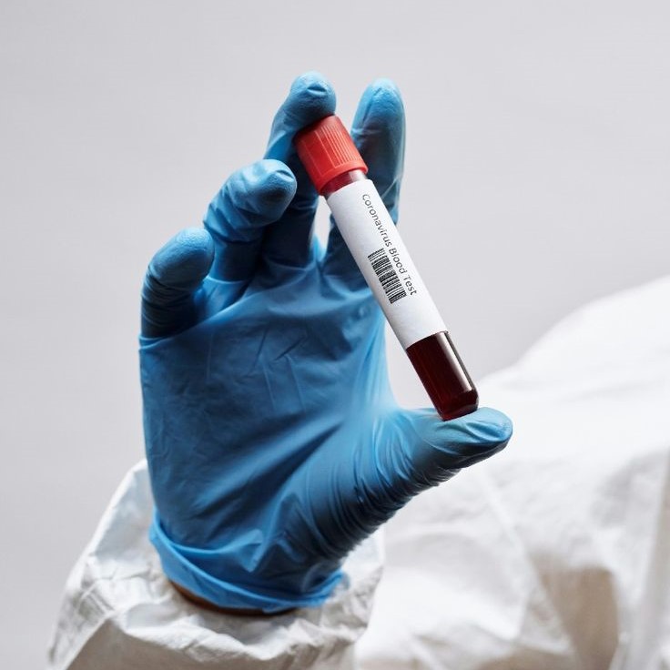 blood test tube
