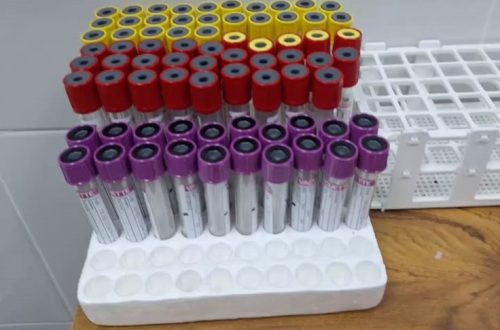 cbc test tube color