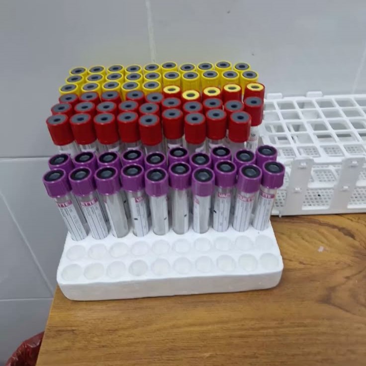 cbc test tube color