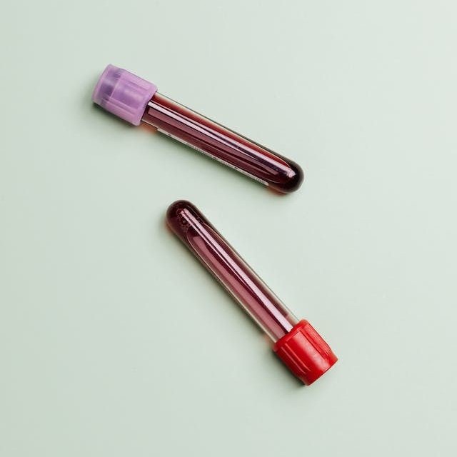 blood test tube