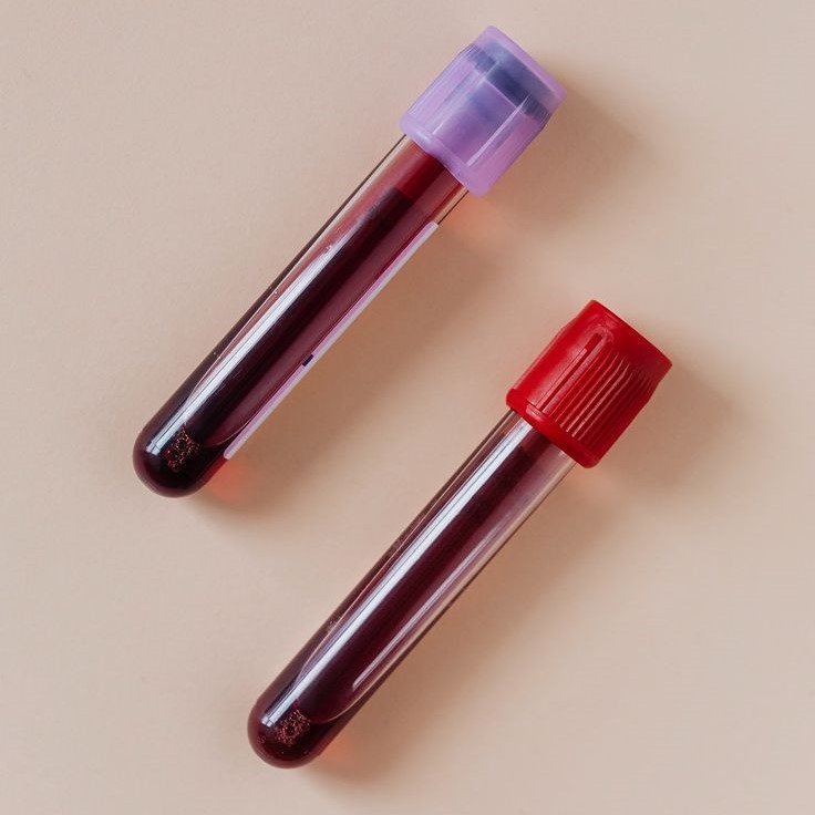 blood test tube