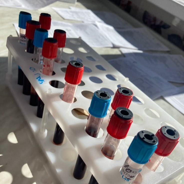 cbc test tube color
