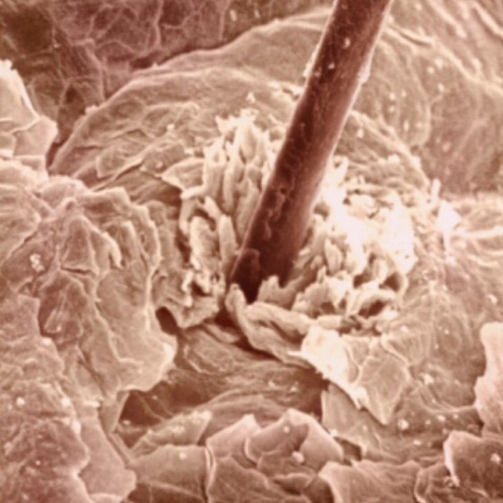 what does skin look like under a microscope