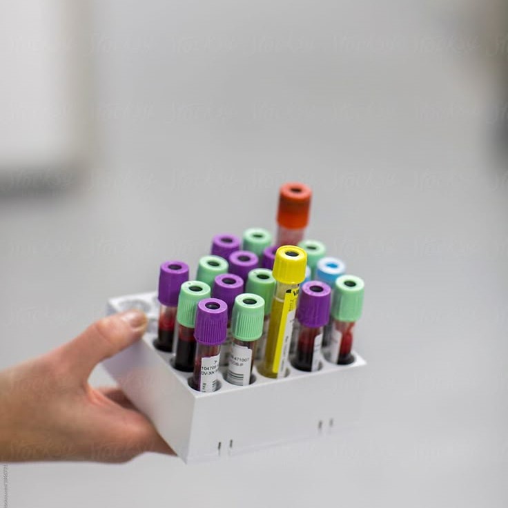 blood test tube