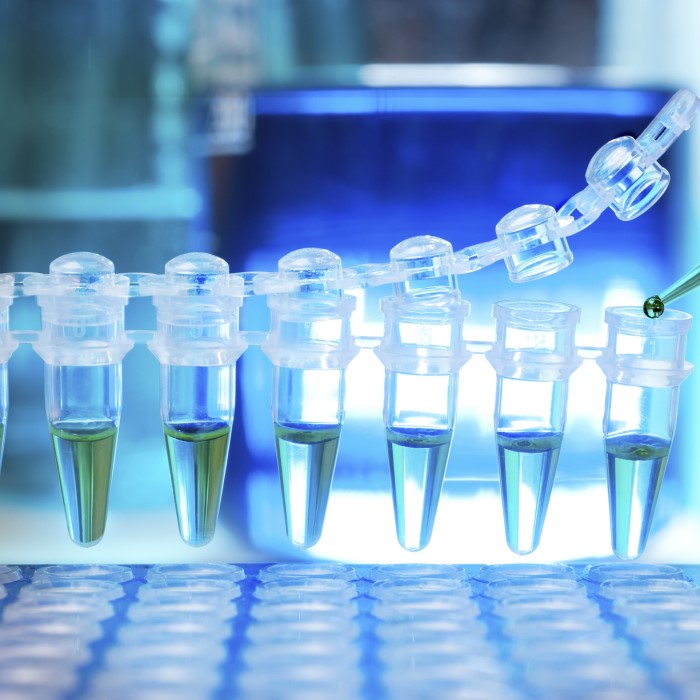 automated dna extraction